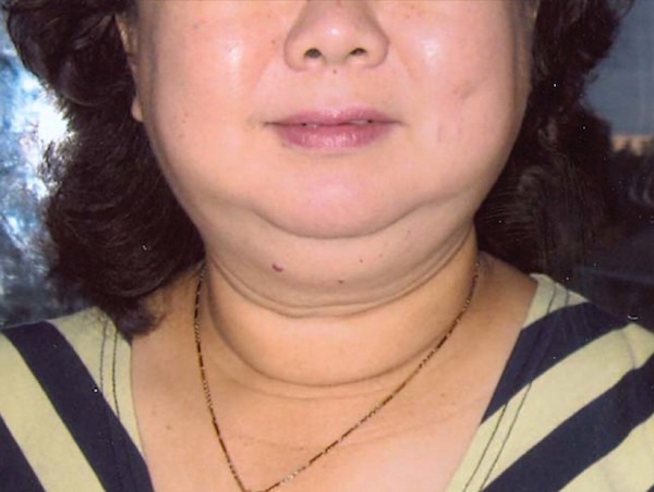 Minden nőnek! Ha neked is vannak szőrszálak az arcodon, nagy veszélyben vagy!