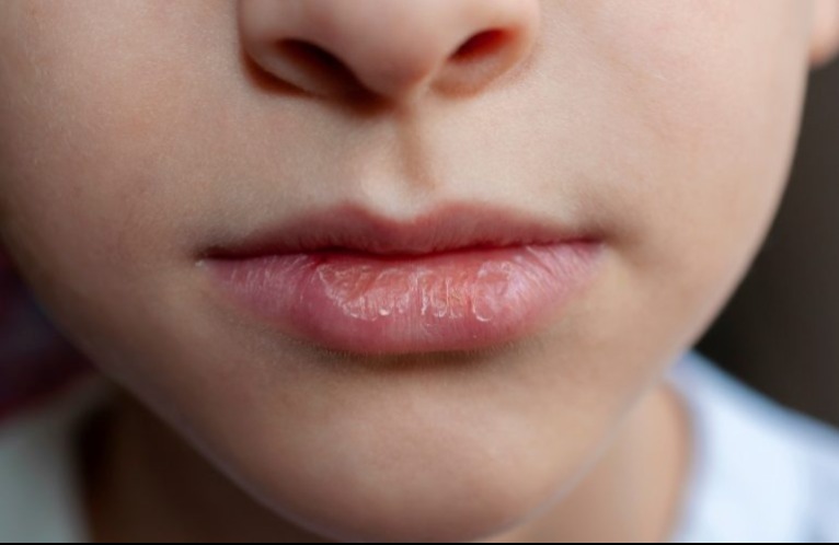 Szájszárazság éjszaka? Erre a súlyos betegségre figyelmeztet minket a szervezetünk!