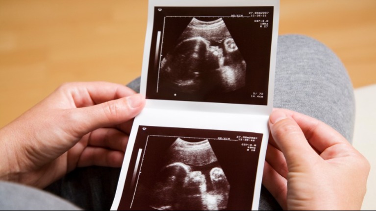 Csak babát akartak, de amit megláttak az ultrahangon attól elhűltek