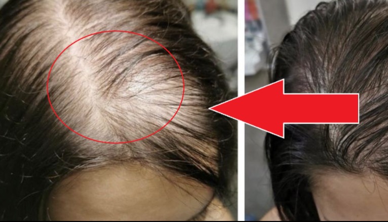 A D-vitamin hiány 10 figyelmeztető tünete