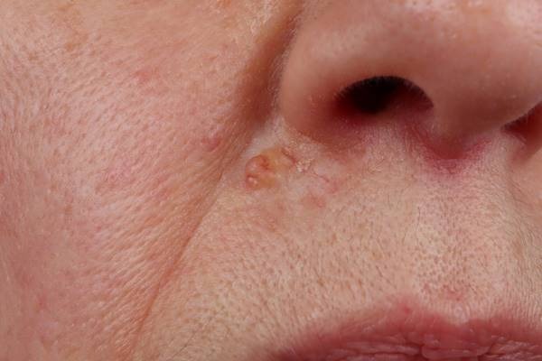 Nem „ártalmatlan panasz”: a rák 8 néma jele, amit a legtöbben figyelmen kívül hagynak