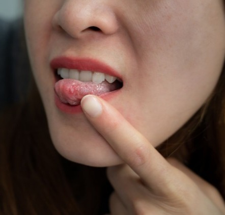 Csípte a nyelvét a chips, az orvos sokkolta a válasszal